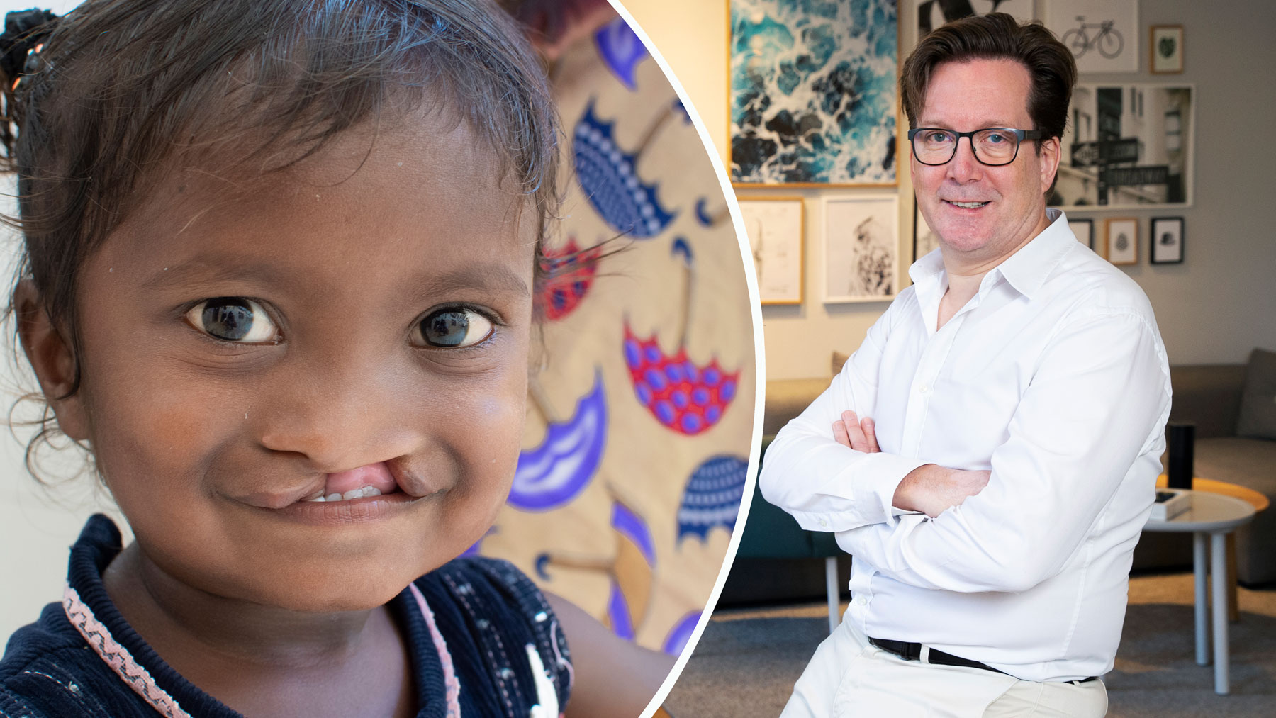 En enkel operation gör skillnad i barns liv – och ny stolthet på jobbet, menar Martin Forsling, vd på Bontouch. Foto: Operation Smile, Martina Huber
